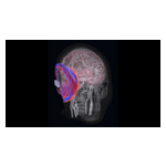 Aleph_Ultrasound_Waves_1.jpg