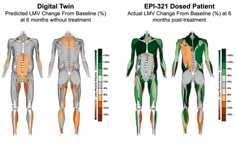 Image caption: MRI images of Lean Muscle Volume (LMV) change from baseline at 6 months for the predicted digital twin without treatment (left) and actual EPI-321 treated patient (right) 6-months post dosing. Images show LMV was predicted to decline due to natural FSHD disease progression (orange colored muscles), but LMV was observed to increase (green muscles) following EPI-321 treatment. Images are from one participant in the study, however the increase in LMV seen here was observed across all n=3 patients 6-months post dosing. Images from Springbok Analytics.