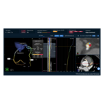 SCCT_PR_Graphic_with_disclaimer.jpg