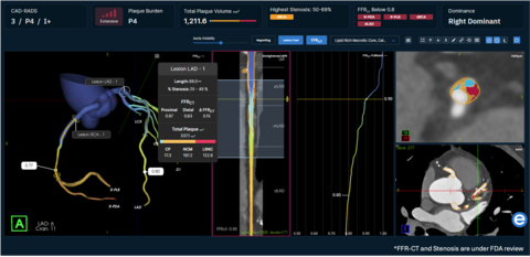 original Elucid’s comprehensive clinical platform. FFR-CT and Stenosis under FDA review