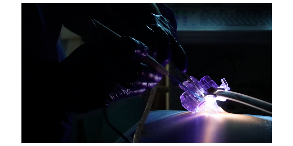 Neo Medical Introduces Instant MIS Access™: A New Platform Designed to Address the Operational Barriers Limiting Minimally Invasive Spine Surgery 1 Neo Instant MIS Access Embargo image 1