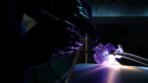 original Neo Instant MIS Access™ supports adaptive, scalable MIS capabilities in any surgical spine facility. Starting here, with Posterior MIS Access, the platform is the start of a new architecture for MIS spine care.