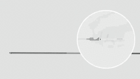 original DRIVEWIRE™ 35 uses controlled tip deflection to shape the wire inside the vessel and add active steering to compatible catheters—helping physicians navigate complex anatomy and streamline access to the treatment site.