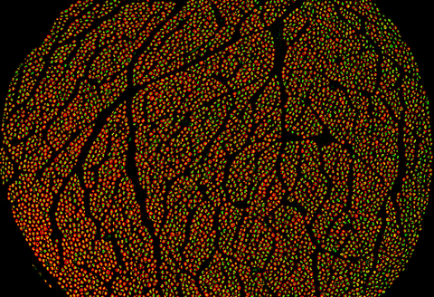The human vagus nerve contains about 100,000 individual nerve fibers, some as small as 0.5 micrometers. Using fluorescent protein markers and high-resolution imaging, researchers can make these tiny fibers visible, show how different fiber types are organized within the nerve bundles, and begin to understand what kinds of information each group of fibers carries. (Credit: Feinstein Institutes)
