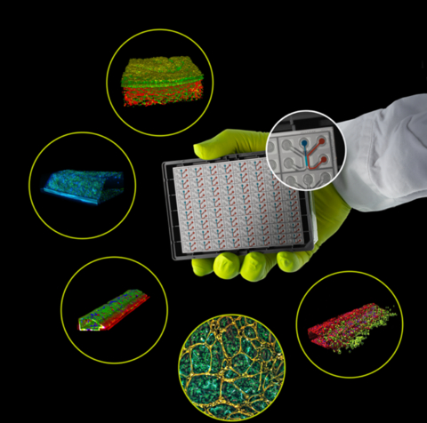 MIMETAS provides scalable organ-on-a-chip solutions for culturing and analyzing human-relevant tissues in a high-throughput plate format. The OrganoPlate® platform enables advanced disease modeling, drug testing, and safety assessment. Shown clockwise from the bottom right: immune cell migration from a blood vessel, a vascularized liver model, a gut tubule, a colon organoid-derived tubule, and a vascularized lung model
