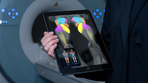original AMRA Medical - Measuring Muscles with Quantitative MRI