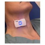 FloPatch pt neck2
