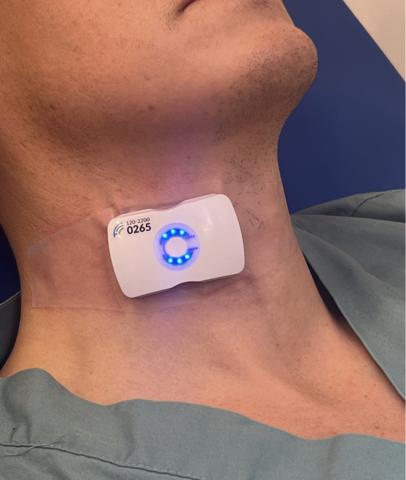 FloPatch, a wearable Doppler ultrasound device, is applied to the neck to measure real-time blood flow and help clinicians make faster, more personalized treatment decisions.