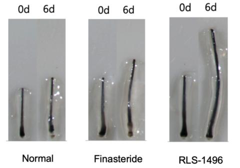 original Figure Legend: Representative images of intact ex vivo human hair follicles challenged with DHT 100 nM and stimulated with finasteride 600 nM (positive control) or RLS-1496 2000 nM at Days 0 and 6.