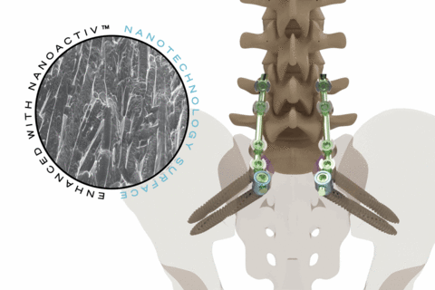 Xenix Medical Riva® Anchor Spinopelvic Fixation System with NanoACTIV™ Surface Technology