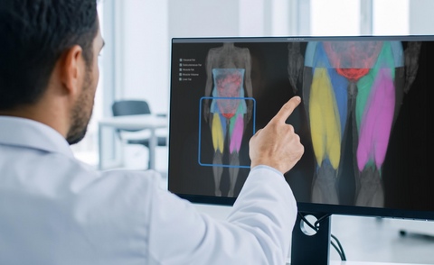 Advanced MRI-based analysis can provide a more detailed view of changes in muscle composition during obesity treatment