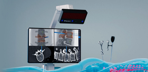 ClaroNav Kolahi Inc. Announces EU MDR Certification for Navient Surgical Navigation System