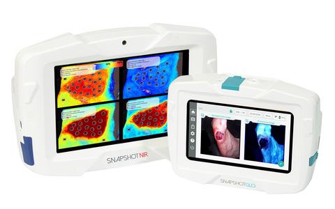 Kent Imaging’s SnapshotNIR and SnapshotGLO work together to reveal two key barriers to repair—low tissue oxygenation and elevated bacterial bioburden.