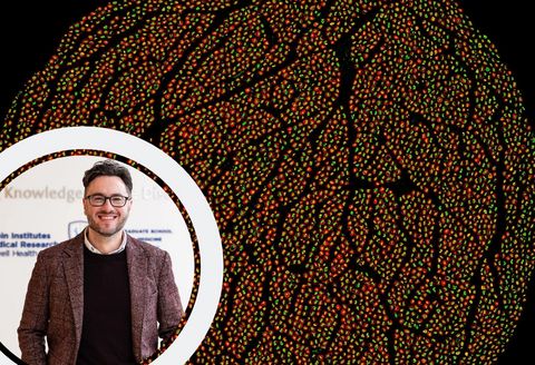 original The human vagus nerve contains about 100,000 individual nerve fibers, some as small as 0.5 micrometers. (Credit: Naveen Jayaprakash, PhD/Feinstein Institutes)